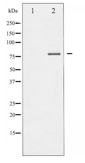 FOXO1 / FKHR Antibody (phospho-Thr24,32)