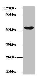 EPHX1 / Epoxide Hydrolase 1 Antibody (aa1-455)