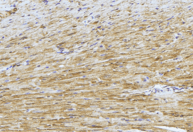 Polyclonal Rabbit anti-Human PDK4 Antibody (IHC, IF, WB)