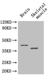 IHC-plus™ SEPP1 / Selenoprotein P Antibody