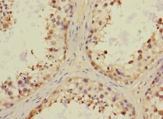 Polyclonal Rabbit anti-Human CHRNA6 Antibody (IHC, WB)