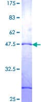 Human ZNF26 Protein (Recombinant GST)