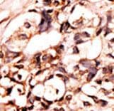 Polyclonal Rabbit anti-Human DAXX Antibody (phospho-Ser213, IHC, WB)