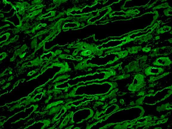 LAMC1 / Laminin Gamma 1 Antibody (clone A5)