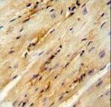 GPD1L Antibody (aa44-73)