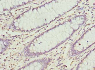 Polyclonal Rabbit anti-Human CXXC4 Antibody (IHC, WB)