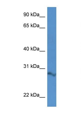 2610034B18Rik Antibody (aa58-107)