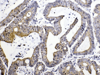 TIMP4 Antibody