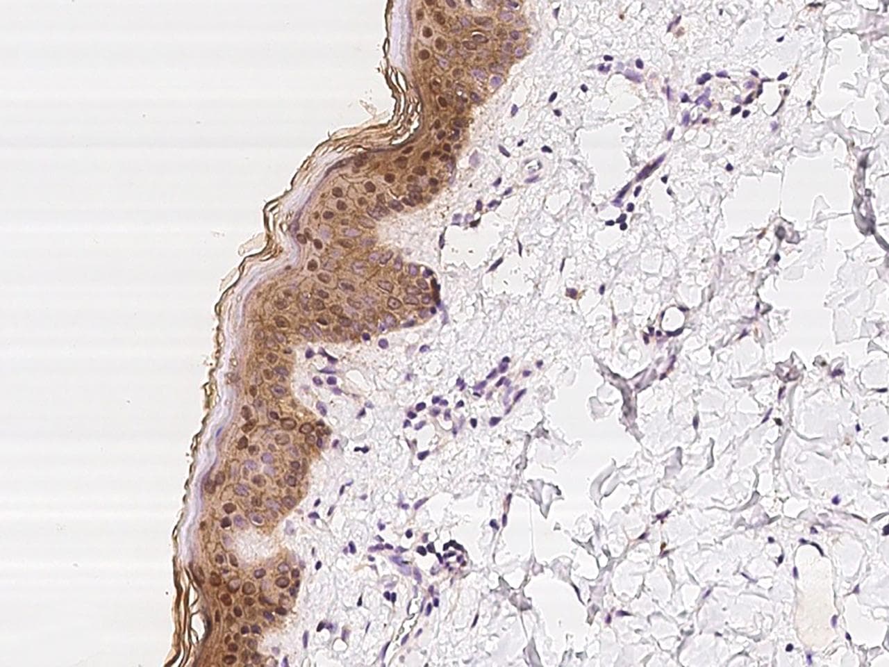 Polyclonal Rabbit anti-Human PKP1 / Plakophilin 1 Antibody (IHC)