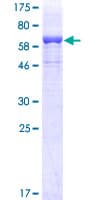 Human LCAT Protein (Recombinant GST)