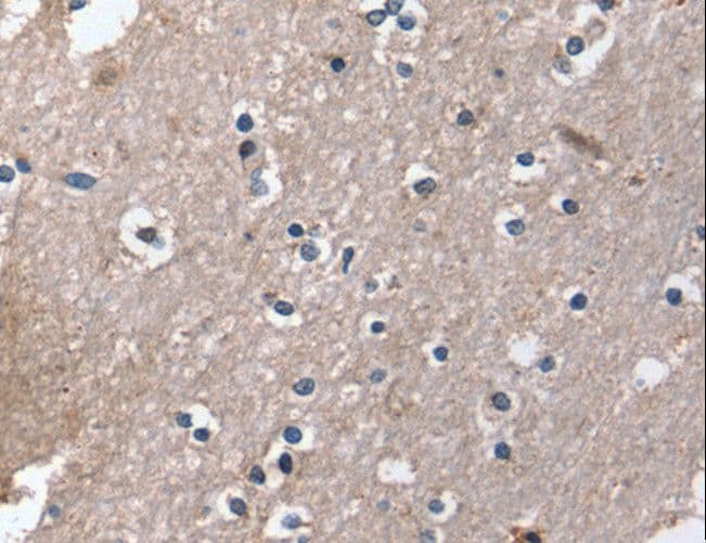 DUT / DUTPase Antibody