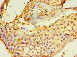 DGKE / DGK Epsilon Antibody (aa40-260)