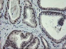ZBED1 / TRAMP Antibody (clone OTI5A2)