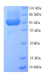 M13 Bacteriophage Attachment Protein G3P (Recombinant His)