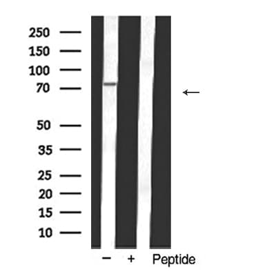 DDX3 / DDX3X Antibody