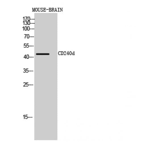 Polyclonal Rabbit anti-Human RHD Antibody (161-210 aa, Internal, WB)