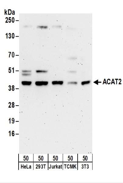 ACAT2 Antibody (aa150-200)