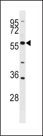 BLK Antibody (aa1-30)