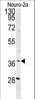 Polyclonal Rabbit anti-Human WDR57 Antibody (aa122-149, IHC, WB)
