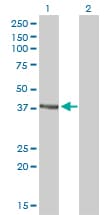 RAD51C Antibody (clone 3F3-5C6)