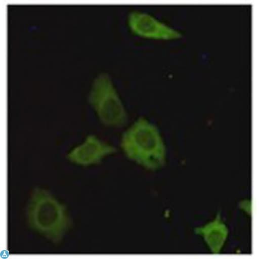 CRTC1 / MECT1 / TORC1 Antibody