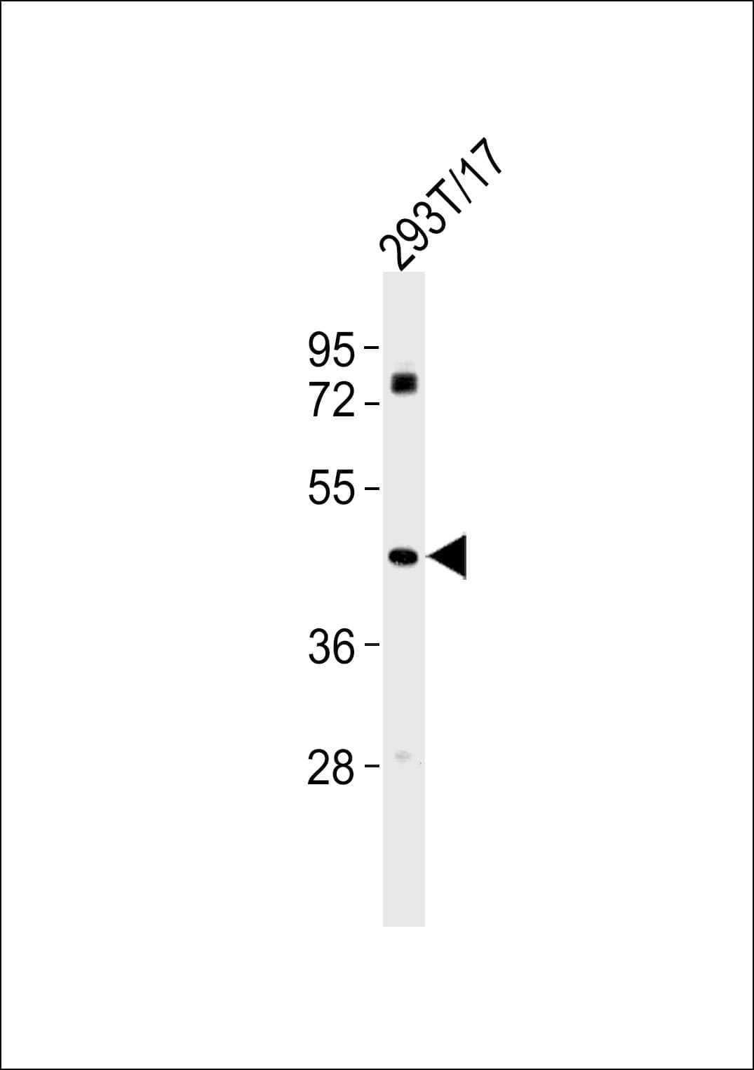 EDNRA / Endothelin A Receptor Antibody