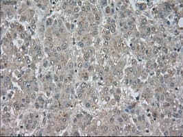 TSC501 / NAT8 Antibody (clone OTI6H3)