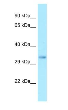 Polyclonal Rabbit anti-Human FFAR2 / GPR43 Antibody (C-Terminus, WB)
