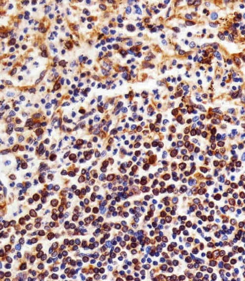 NFKB1 / NF-Kappa-B Antibody (clone 1298CT792.105.117.133)