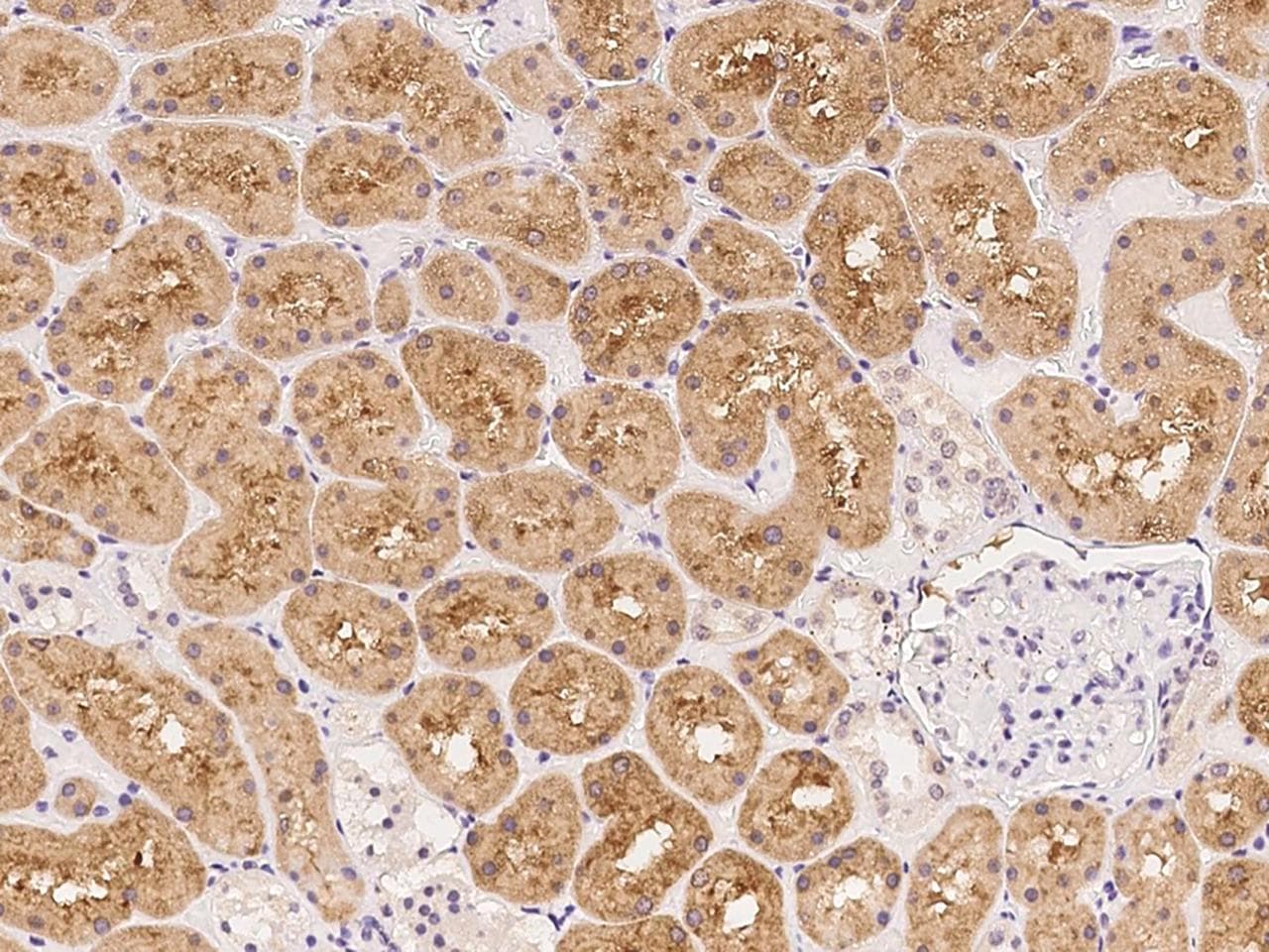 Polyclonal Rabbit anti-Human C21orf2 Antibody (IHC)