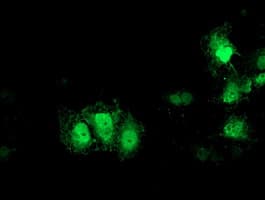 GDAP1L1 Antibody (clone OTI1C3)