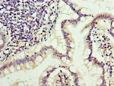 TRBC1 Antibody (aa1-177)