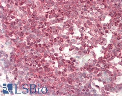 IHC-plus™ ZNF148 / ZBP-89 Antibody (aa375-425)