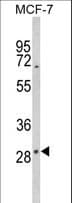 DIO2 Antibody (aa165-191)