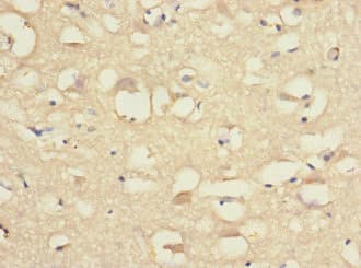 Polyclonal Rabbit anti-Human CNTN4 Antibody (IHC, WB)