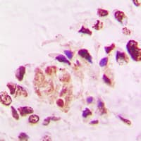 THRA / THR Alpha Antibody (N-Terminus)
