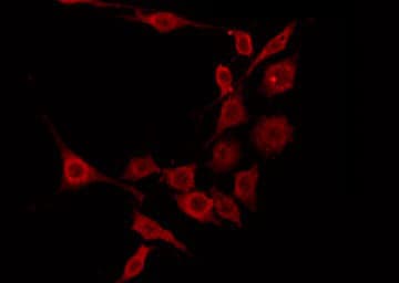 Polyclonal Rabbit anti-Human EHHADH / Enoyl-Coa Hydratase Antibody (IHC, IF, WB)