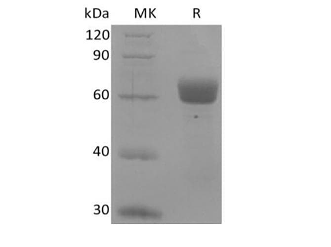 Human BTNL9 Protein (Recombinant Fc, C-terminus)