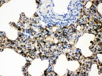 Polyclonal Rabbit anti-Human SFTPA1 + SFTPA2 Antibody (IHC, WB)