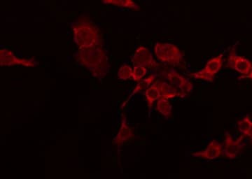 CD30L / CD153 Antibody