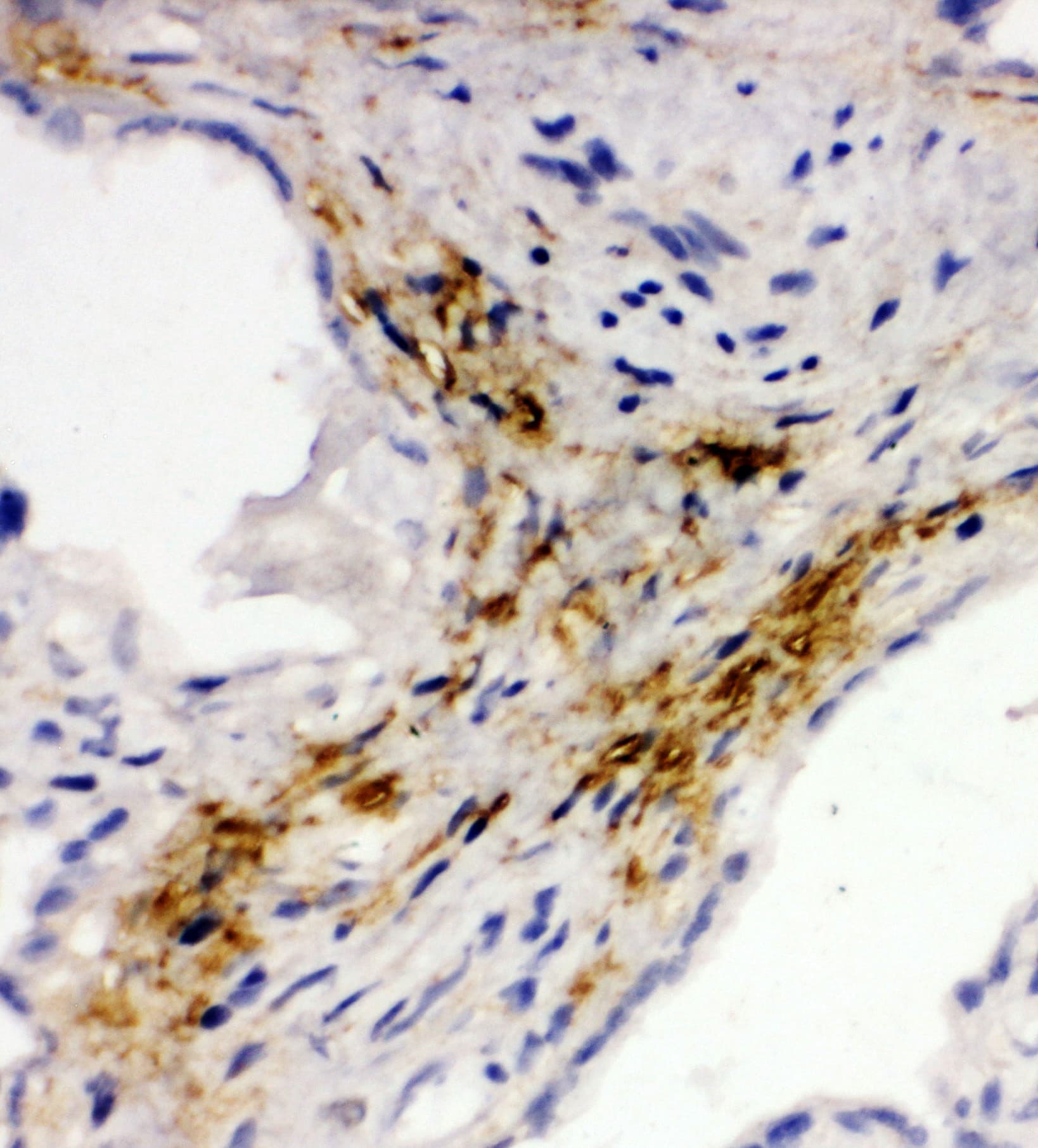 MAdCAM-1 Antibody (aa173-190)