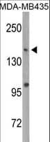 Polyclonal Rabbit anti-Human DNMT / DNMT1 Antibody (Ser1105, WB)