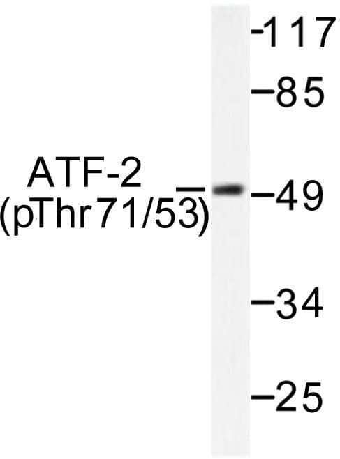 ATF2 Antibody (phospho-Thr71)