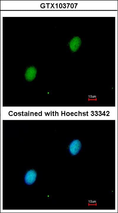 IHC-plus™ HIF2A / EPAS1 Antibody