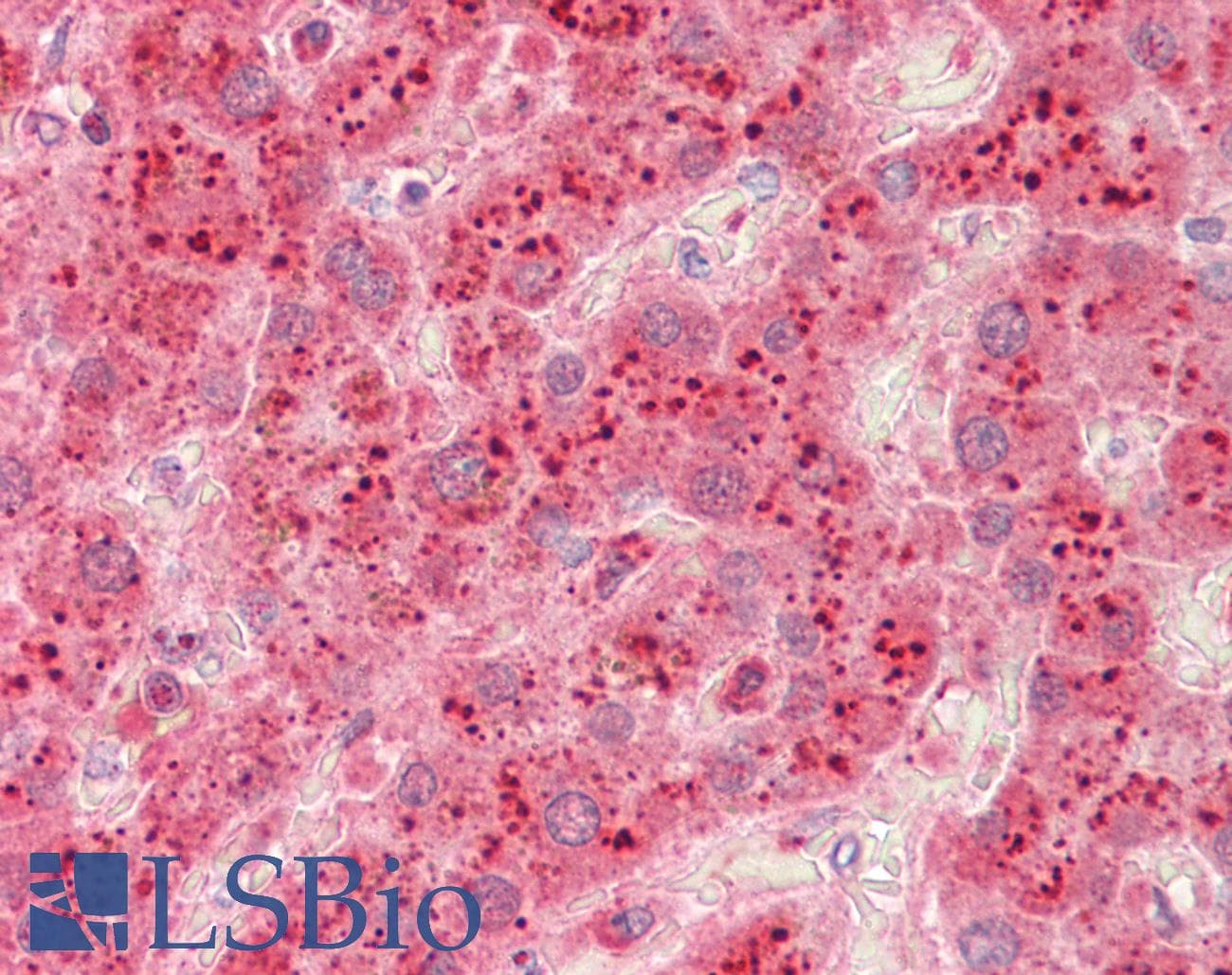 IHC-plus™ Polyclonal Rabbit anti-Human Beta Galactosidase Antibody (aa166-677, IHC, WB)