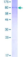 Human FANCG Protein (Recombinant GST)