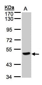 Polyclonal Rabbit anti-Human PGCP / Aminopeptidase Antibody (aa19-296, IHC, WB)