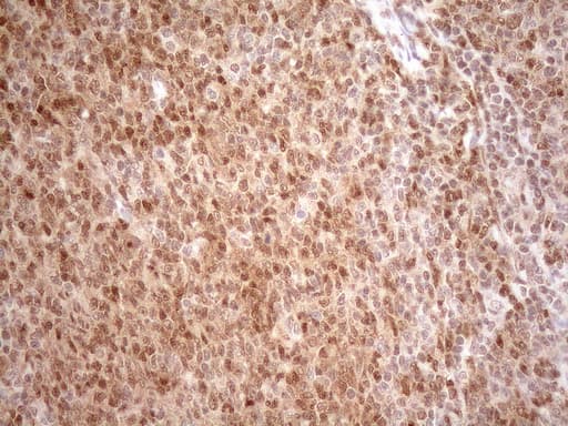 Monoclonal Mouse anti-Human MGMT Antibody (clone OTI2F10, IHC, WB)