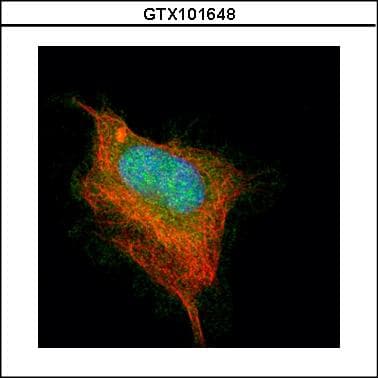 ACHE / Acetylcholinesterase Antibody (aa406-614)