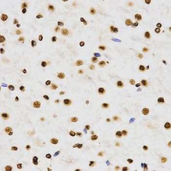 Histone H3 Antibody (Di-Methyl-Lys9)